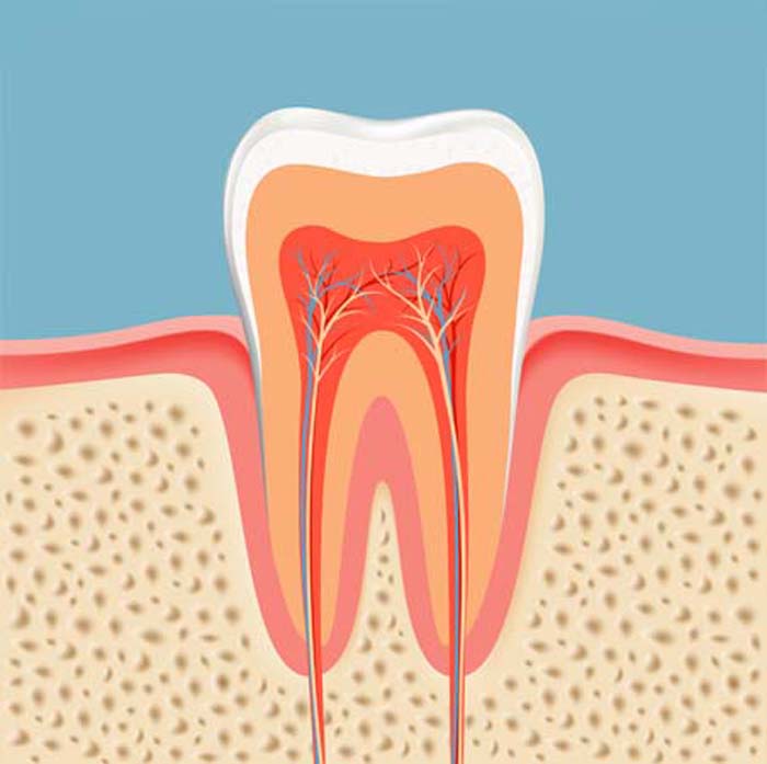 Graphic image of root canal tooth