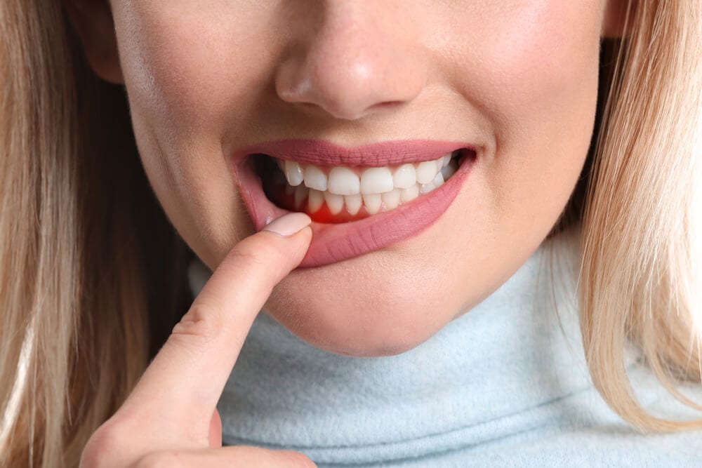featured imaged for services post, female holding gum from periodontal work